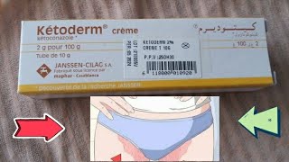 علاج الفطريات واحمرار بين الفخدين خلال ايام كيفية استخدام كريم كيتوديرم ketoderm [upl. by Aenel]