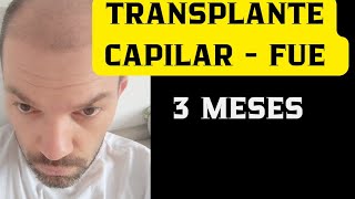 TRANSPLANTE CAPILAR  FUE 3 MESES PÓS OPERATÓRIO [upl. by Nnasor]