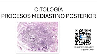 Citología de “Mediastino Posterior” [upl. by Nyad]