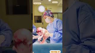 CSECTION delivery viralvideo hospital shortvideo duty youtube docter respect mdmedical00 [upl. by Esirtal]