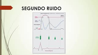 Ruidos Cardíacos Normales y Patológicos [upl. by Oirogerg]