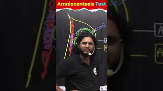 Amniocentesis Test क्या है 🔥🔥🔥 shorts ytshorts ‪lover [upl. by Siderf243]