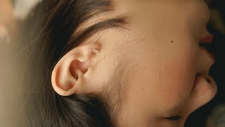 What is a perforated eardrum  Patient Explainers [upl. by Lily]