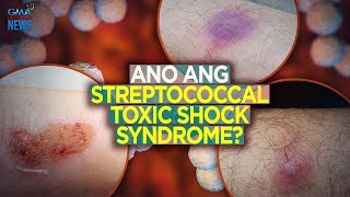 Ano ang Streptococcal Toxic Shock Syndrome  Need to Know [upl. by Neo879]