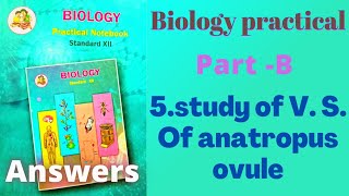 5study of V S Of anatropus ovule Biology practical class 12 practical 5 [upl. by Eecram]