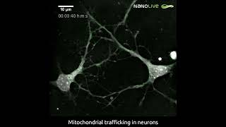 Visualizing mitochondrial trafficking in neurons [upl. by Enilekaj]