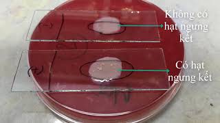 Thử nghiệm Coagulase  Slide and Tube Coagulase Test  Nhóm 2  Tổ 3  Xét nghiệm 9B  HMTU [upl. by Annoyi]