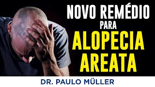 Ritlecitinib Novo Medicamento para Alopecia Areata – Dr Paulo Muller Dermatologista [upl. by Jeaz]