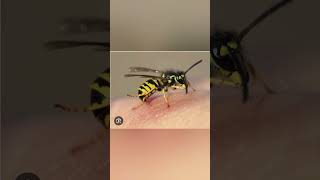 Bee sting firstaidmanagement publicawareness ministryofhealth viralvideo [upl. by Chiou]