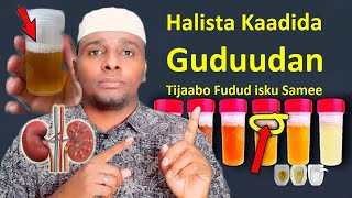 Midabka kaadida waxa utusayo kelyaha iyo Beerka siday noqdaan Halista muslimiin Badan ogeyn [upl. by Iggem]