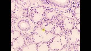 mixed secretory units submandibular gland [upl. by Healey]