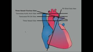 Advanced Evaluation of the Fetal Heart [upl. by Sivle544]