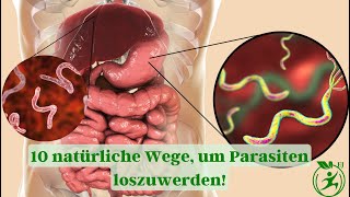 10 natürliche Wege um Darmwürmer und Parasiten in kürzester Zeit loszuwerden [upl. by Olegnaleahcim]