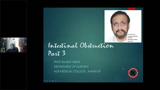 Systemic Surgery Lectures Intestinal Obstruction Part 3 [upl. by Rosalba]