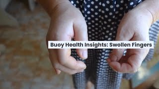 Swollen Fingers Common Causes and When to Seek Medical Care  BuoyHealthcom [upl. by Zerat]