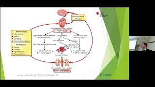 Congestive Heart Failure Symptoms Stages and Treatments [upl. by Assirec]