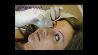 Permanent eyeliner  Makeup  Before and After  Tutorial by Redeem Clinic [upl. by Nicolella66]