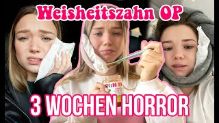 Meine Weisheitszahn OP AN WEIHNACHTEN und der extreme Horror danach [upl. by Preston764]