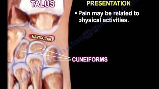 Kohlers Disease  Everything You Need To Know  Dr Nabil Ebraheim [upl. by Stefanac422]