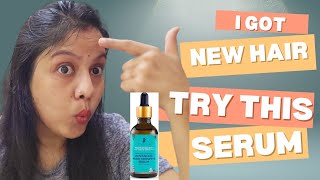 best hair growth Serum for faster hair growth amp control hairfall Pilgrim hair growth Serum review [upl. by Vasiliki274]