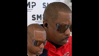 Scalp Micropigmentation SMP in Central KY [upl. by Natloz]