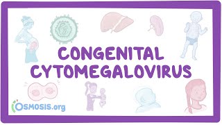 Congenital CMV  causes symptoms diagnosis treatment pathology [upl. by Candra]