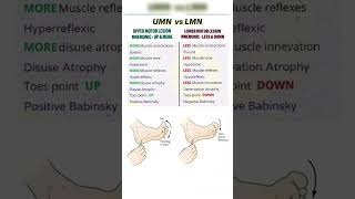 Easy way to learn UMN amp LMN physiotherapy medicalstudent learning shorts shortvideo [upl. by Ardnauqal]