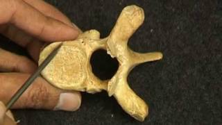 Osteology VivaVertebrae by Ghanashyam Vaidya [upl. by Polak864]