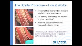 Stretta Patient Webinar 2017 Dr Reiss [upl. by Balling]