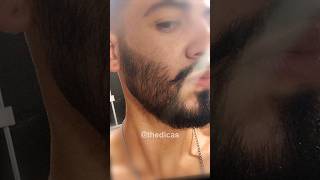 1 ANO USANDO MINOXIDIL evolução minoxidil minoxidil barba [upl. by Nortad]