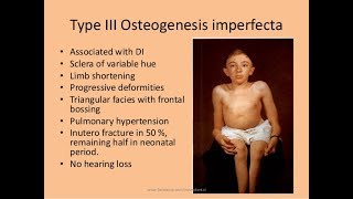 Osteogenesis imperfecta tipo III  Terapia ocupacional [upl. by Nakashima]