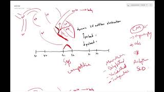 Hypertrophic obstructive cardiomyopathy HOCM  Dr Jamal USMLE [upl. by Cannell]