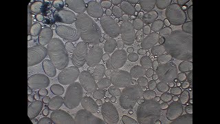 starch grains under microscope [upl. by Adehsar]