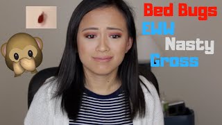 BED BUGS EWW  Story Time [upl. by Iahs]