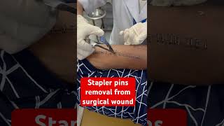 Multiple ways to close a surgical wound 1 nylon sutures 2 skin staplers 3 dermabond woundcare [upl. by Wieche]