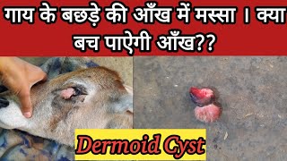 Dermoid Cyst in Cow Calf Eyeबछड़े की आँख में मस्सा। [upl. by Navert]