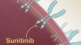 Treating Advanced RenalCell Carcinoma [upl. by Efron]