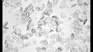 Heat Gelatinization of Wheat Starch low iodine [upl. by Yeltnarb317]