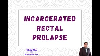 INCARCERATED RECTAL PROLAPSE [upl. by Hars]