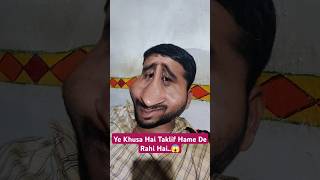 Ye Khusa Hai Taklif Hame De Rahi Hai  ये ख़ुसा है तक़लीफ़ हमें दे रही है miganeshbhau comedyshort [upl. by Tess]