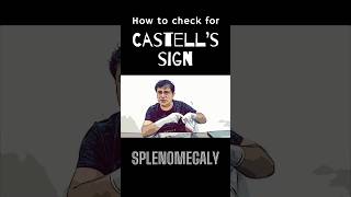 What is Castell’s sign in splenomegaly shorts splenomegaly spleenanatomy [upl. by Theresina]