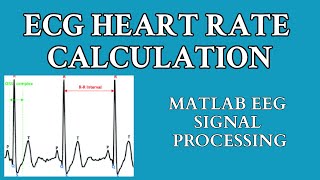 ECG Signal Processing using MATLAB  ECG Heart Rate Calculation  RPeaks Detection [upl. by Eittak]