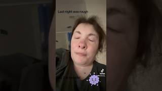 Day 2  post op from surgery surgery postoprecovery 2024 surgery vlog part 2 [upl. by Keelia]