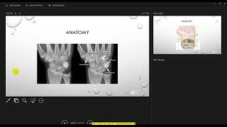 wrist arthrography tips and tricks [upl. by Rimidalg210]