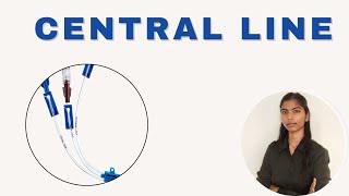 central line ports [upl. by Ninahs]