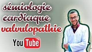 sémiologie cardiaque valvulopathie gauche [upl. by Ten]