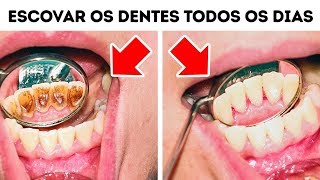 10 Erros Que Você Comete Ao Cuidar Dos Dentes [upl. by Ybot]