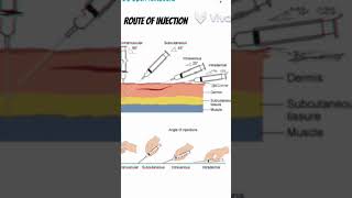 Different route of injection administration of drugs route injection shorts 3danimation viral [upl. by Alohcin]