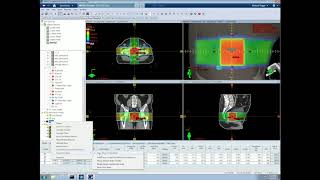 Tutorial 4 Basic 3D Planning in Eclipse [upl. by Nile]