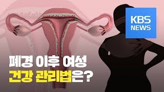 199회 폐경 이후 여성…호르몬 치료는 선택이 아닌 필수  KBS뉴스News [upl. by Ylesara]